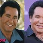 Image result for Wayne Newton Before and After