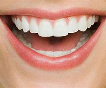 Image result for Calculuspet Teeth Cleaning Kit