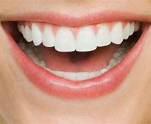 Image result for Teeth Infographic