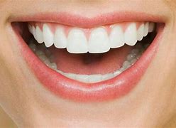 Image result for Homemade Teeth Whitening