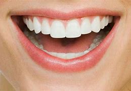 Image result for Carbonated Water Teeth