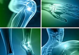 Image result for Orthopedic Sports Medicine