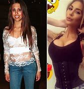 Image result for Chloe Lattanzi Before After