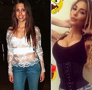 Image result for Chloe Rose Lattanzi Before After