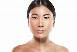 Image result for Bleaching Your Skin