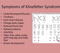 Image result for Klinefelter's Syndrome Life Expectancy