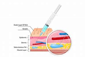 Image result for Subcutaneous