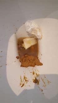 Image result for Diarrhea Poop