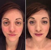 Image result for Arbonne Before and After
