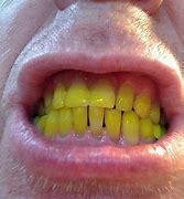 Image result for Clean and White Teeth Kids