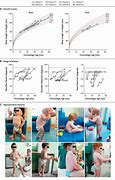 Image result for Hurler Syndrome Gene Therapy
