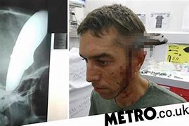 Image result for Stabbed Head