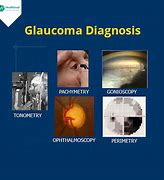 Image result for Glaucoma Procedure