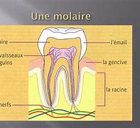 Image result for Molaire Dent