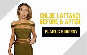Image result for Chloe Rose Lattanzi Plastic Surgery Which Part