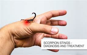 Image result for Texas Scorpion Bites On Humans