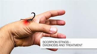 Image result for Scorpion Sting