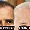 Image result for Biden's Hair Restoration