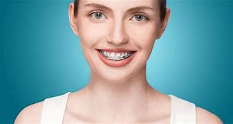 Image result for How to Floss with Braces