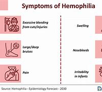 Image result for Hemophilia B Symptoms