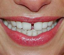 Image result for Clean Your Teeth