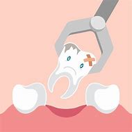 Image result for Extraction Dent