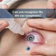 Image result for Dry Eye Syndrome