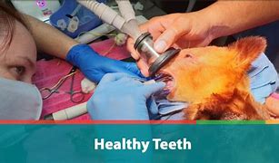 Image result for Healthy Teeth and Gums