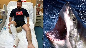 Image result for Shark Kills Man