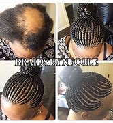Image result for Braids for Women with Alopecia