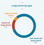 Image result for Lung Cancer Progression Stages