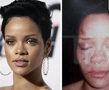 Image result for Rihanna and Chris Brown Assault