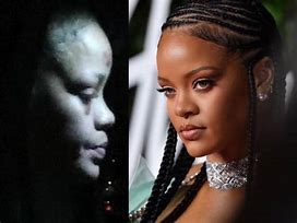 Image result for Rihanna Bruises