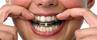 Image result for Mouth Appliance