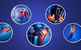 Image result for Orthopedic Services