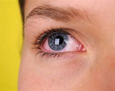 Image result for Scratched Out Eyes