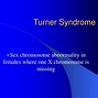 Image result for Turner Syndrome Mosaicism