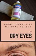 Image result for Dry Eyes Remedies