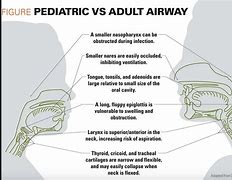 Image result for Child Vs. Adult Airway