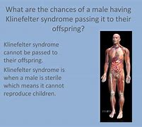 Image result for Klinefelter's Men