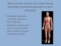 Image result for Men with Klinefelter's Syndrome Symptoms