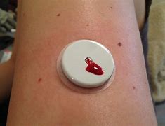 Image result for Freestyle Libre Needle
