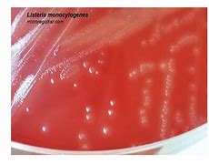 Image result for Listeria Monocytogenes On Blood Agar