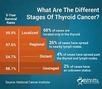 Image result for Stage 4 Thyroid Cancer