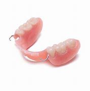Image result for Stayplate Dental
