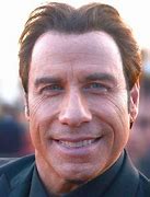 Image result for John Travolta Hair Plugs