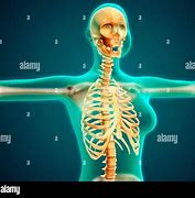 Image result for Female Rib Cage X-ray