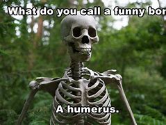Image result for Funny Broken Bone Jokes