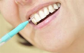 Image result for Oral Hygiene Routine