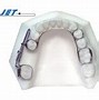 Image result for Mesial Jet
